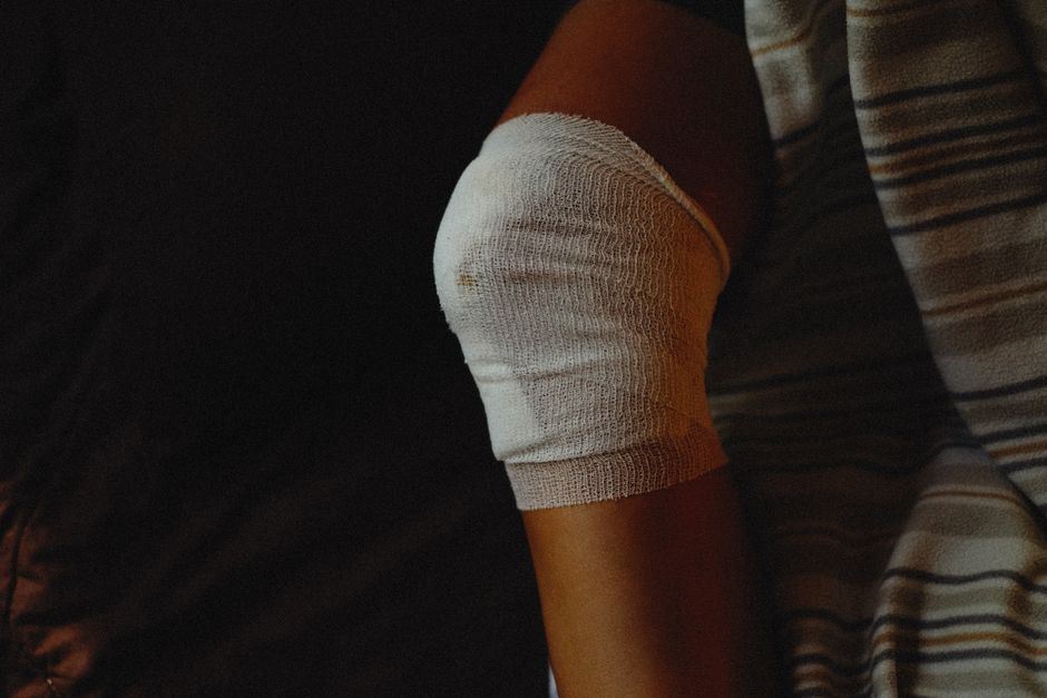Back of Knee Swells After Standing